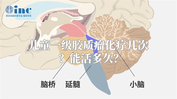 儿童一级胶质瘤化疗几次？能活多久？