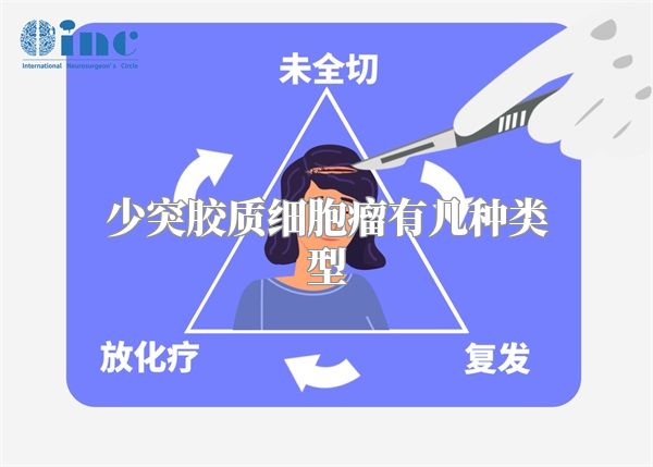 少突胶质细胞瘤有几种类型