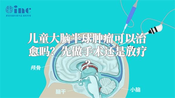 儿童大脑半球肿瘤可以治愈吗？先做手术还是放疗？