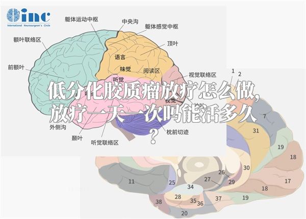 低分化胶质瘤放疗怎么做，放疗一天一次吗能活多久？