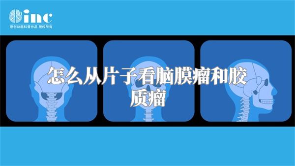 怎么从片子看脑膜瘤和胶质瘤
