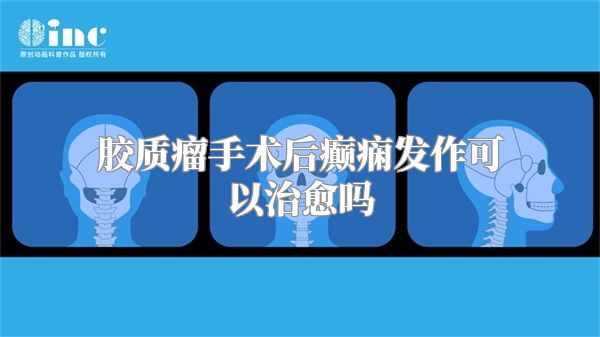 胶质瘤手术后癫痫发作可以治愈吗