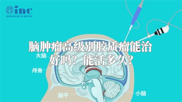 脑肿瘤高级别胶质瘤能治好吗？能活多久？