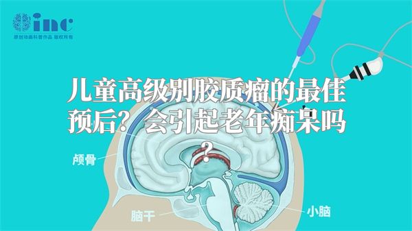 儿童高级别胶质瘤的最佳预后？会引起老年痴呆吗？