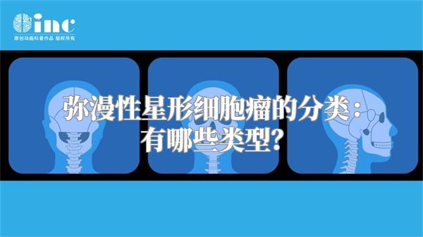 弥漫性星形细胞瘤的分类：有哪些类型？