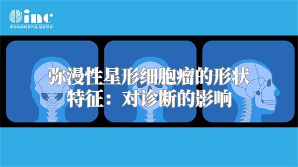 弥漫性星形细胞瘤的形状特征：对诊断的影响