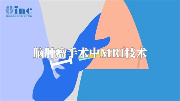 脑肿瘤手术中MRI技术