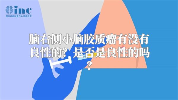 脑右侧小脑胶质瘤有没有良性的？是否是良性的吗？