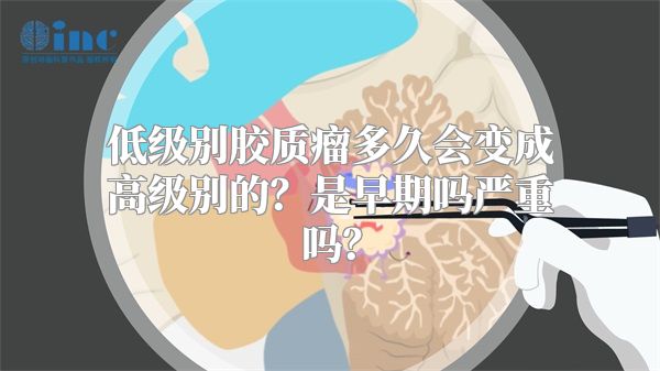 低级别胶质瘤多久会变成高级别的？是早期吗严重吗？