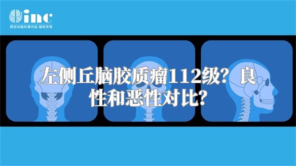左侧丘脑胶质瘤112级？良性和恶性对比？