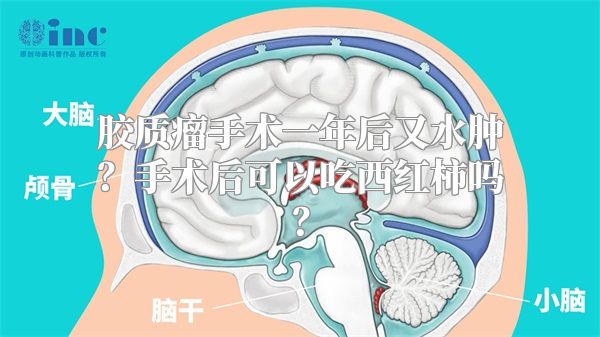 胶质瘤手术一年后又水肿？手术后可以吃西红柿吗？