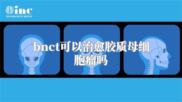 bnct可以治愈胶质母细胞瘤吗