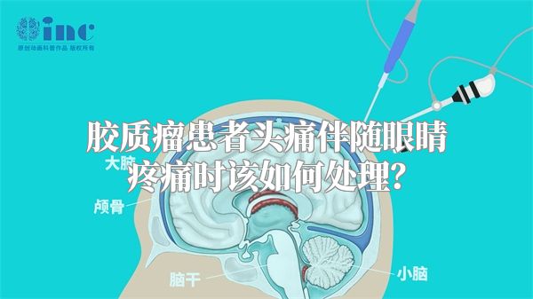 胶质瘤患者头痛伴随眼睛疼痛时该如何处理？