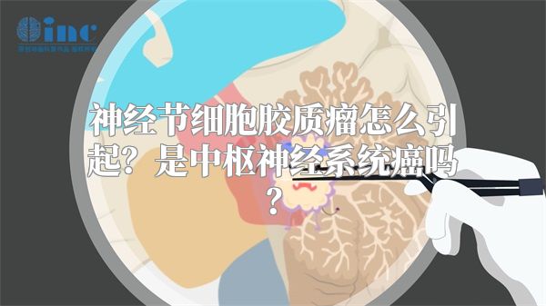 神经节细胞胶质瘤怎么引起？是中枢神经系统癌吗？