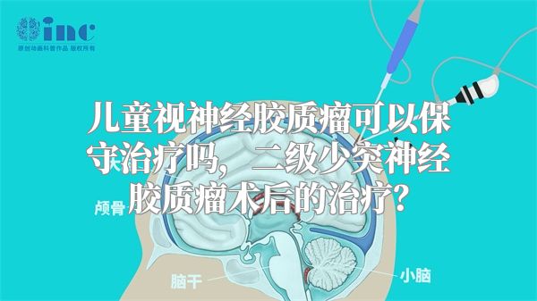 儿童视神经胶质瘤可以保守治疗吗，二级少突神经胶质瘤术后的治疗？
