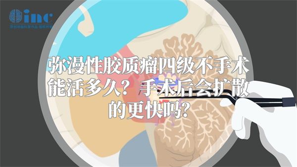 弥漫性胶质瘤四级不手术能活多久？手术后会扩散的更快吗？
