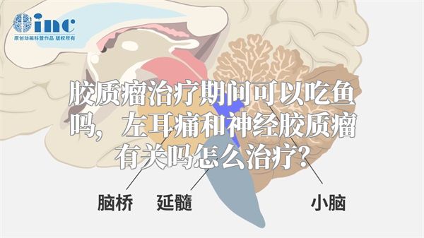 胶质瘤治疗期间可以吃鱼吗，左耳痛和神经胶质瘤有关吗怎么治疗？