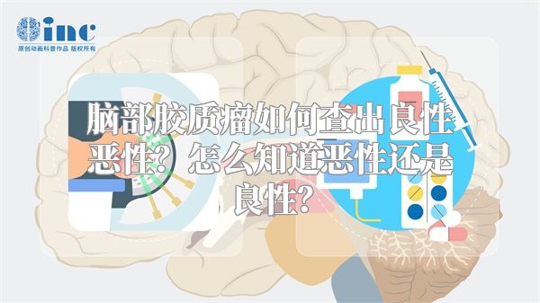 脑部胶质瘤如何查出良性恶性？怎么知道恶性还是良性？
