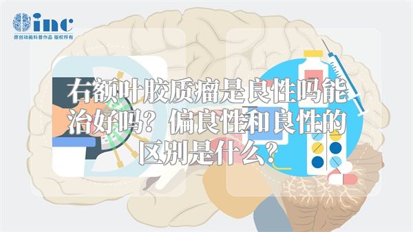 右额叶胶质瘤是良性吗能治好吗？偏良性和良性的区别是什么？