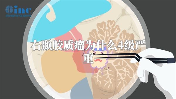 右颞胶质瘤为什么4级严重