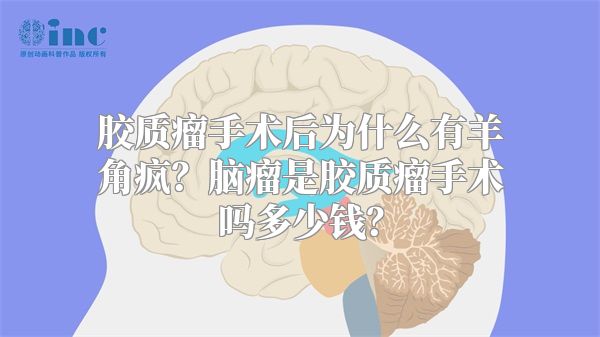 胶质瘤手术后为什么有羊角疯？脑瘤是胶质瘤手术吗多少钱？