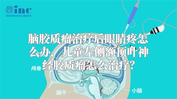 脑胶质瘤治疗后眼睛疼怎么办，儿童左侧额顶叶神经胶质瘤怎么治疗？