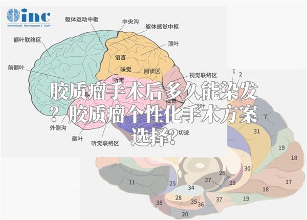 胶质瘤手术后多久能染发？胶质瘤个性化手术方案选择？