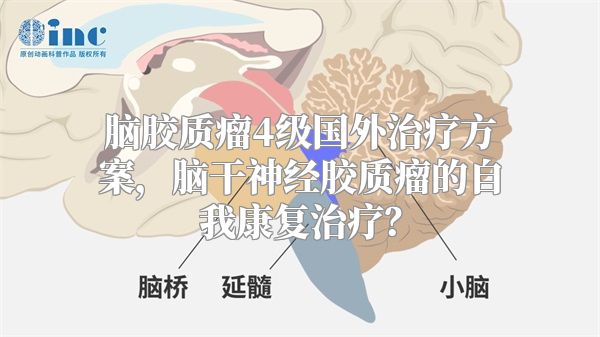 脑胶质瘤4级国外治疗方案，脑干神经胶质瘤的自我康复治疗？