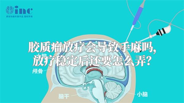 胶质瘤放疗会导致手麻吗，放疗稳定后还要怎么弄？
