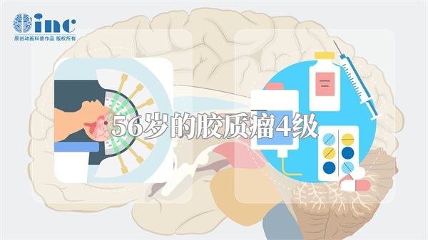 56岁的胶质瘤4级