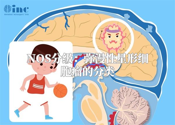 NOS分级：弥漫性星形细胞瘤的分类