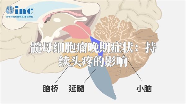 髓母细胞瘤晚期症状：持续头疼的影响