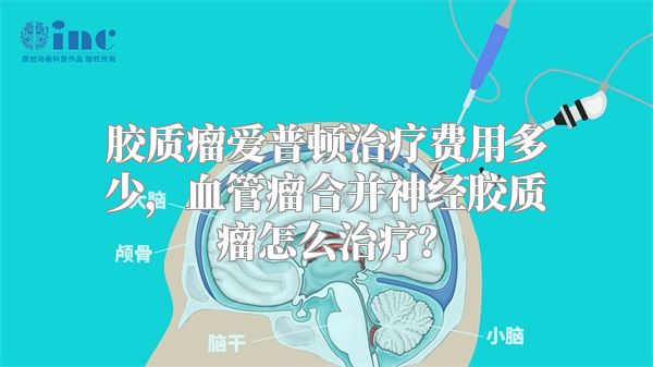 胶质瘤爱普顿治疗费用多少，血管瘤合并神经胶质瘤怎么治疗？