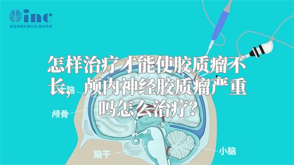 怎样治疗才能使胶质瘤不长，颅内神经胶质瘤严重吗怎么治疗？