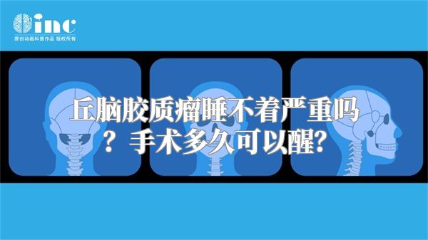 丘脑胶质瘤睡不着严重吗？手术多久可以醒？