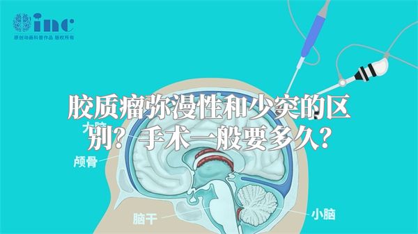 胶质瘤弥漫性和少突的区别？手术一般要多久？