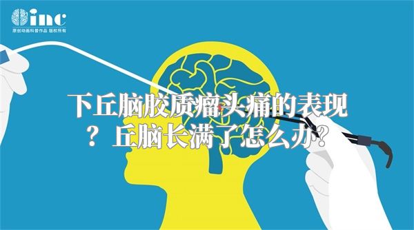 下丘脑胶质瘤头痛的表现？丘脑长满了怎么办？