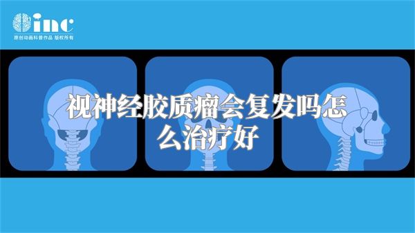 视神经胶质瘤会复发吗怎么治疗好