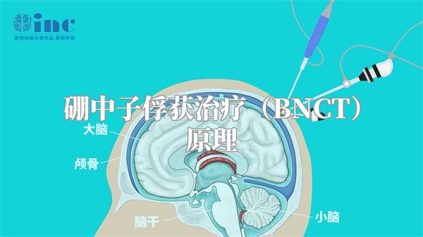 硼中子俘获治疗（BNCT）原理