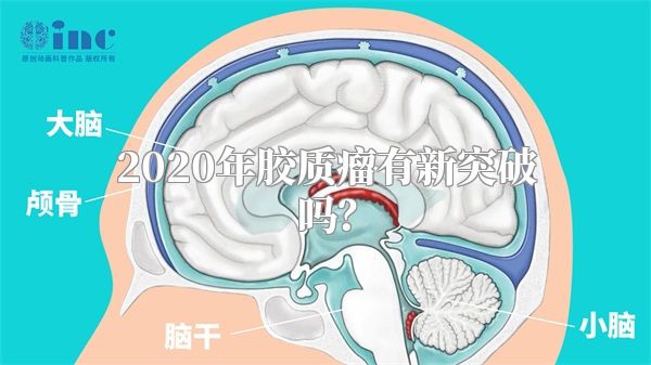 2020年胶质瘤有新突破吗？