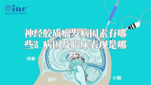 神经胶质瘤发病因素有哪些？病因及临床表现是哪些？