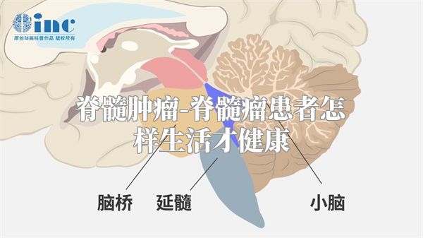 脊髓肿瘤-脊髓瘤患者怎样生活才健康