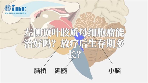 左侧顶叶胶质母细胞瘤能治好吗？放疗后生存期多长？