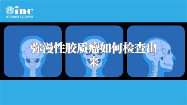 弥漫性胶质瘤如何检查出来