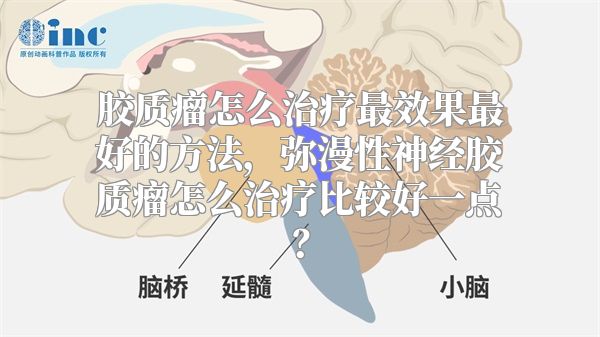 胶质瘤怎么治疗最效果最好的方法，弥漫性神经胶质瘤怎么治疗比较好一点？