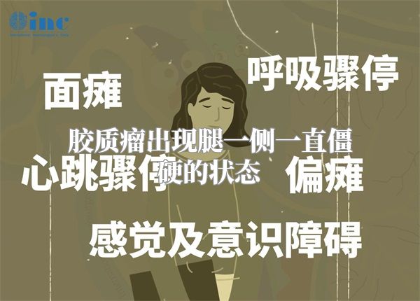 胶质瘤出现腿一侧一直僵硬的状态