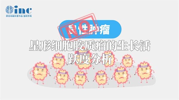 星形细胞胶质瘤的生长活跃度分析