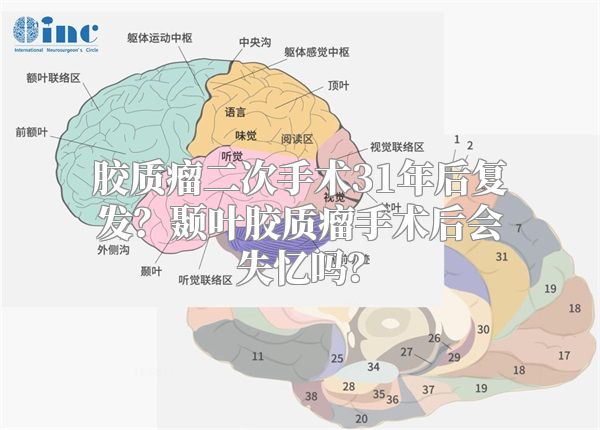 胶质瘤二次手术31年后复发？颞叶胶质瘤手术后会失忆吗？