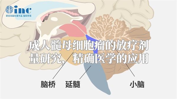 成人髓母细胞瘤的放疗剂量研究，精确医学的应用