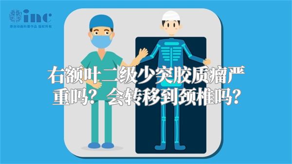 右额叶二级少突胶质瘤严重吗？会转移到颈椎吗？